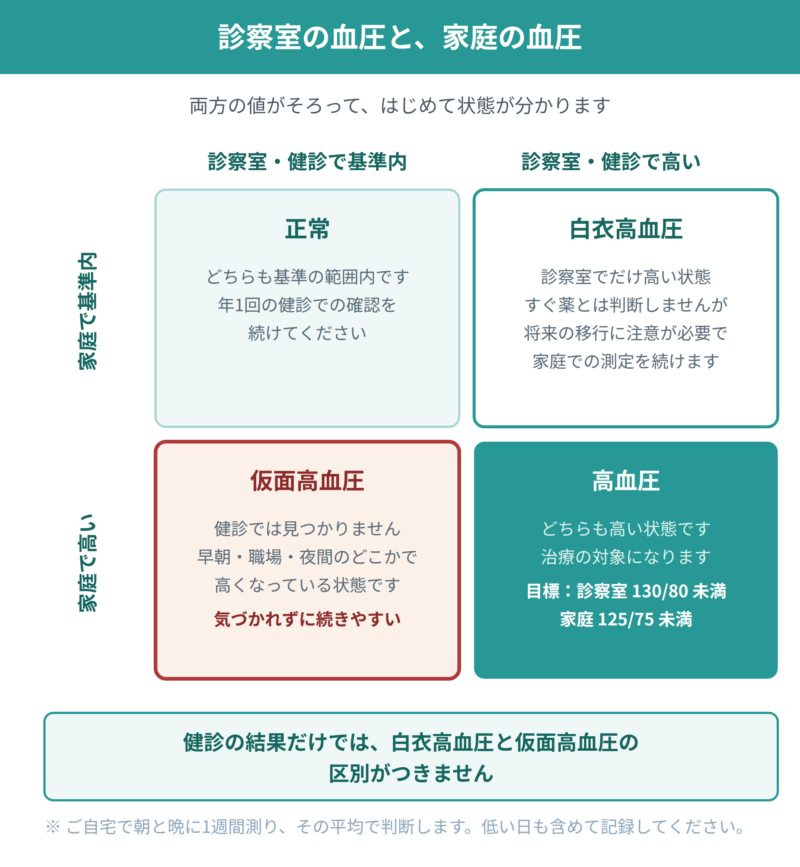診察室・健診で測った血圧と、家庭で測った血圧の組み合わせを4つに分類した図。正常、白衣高血圧、仮面高血圧、高血圧のそれぞれについて、状態と対応の考え方を示している。