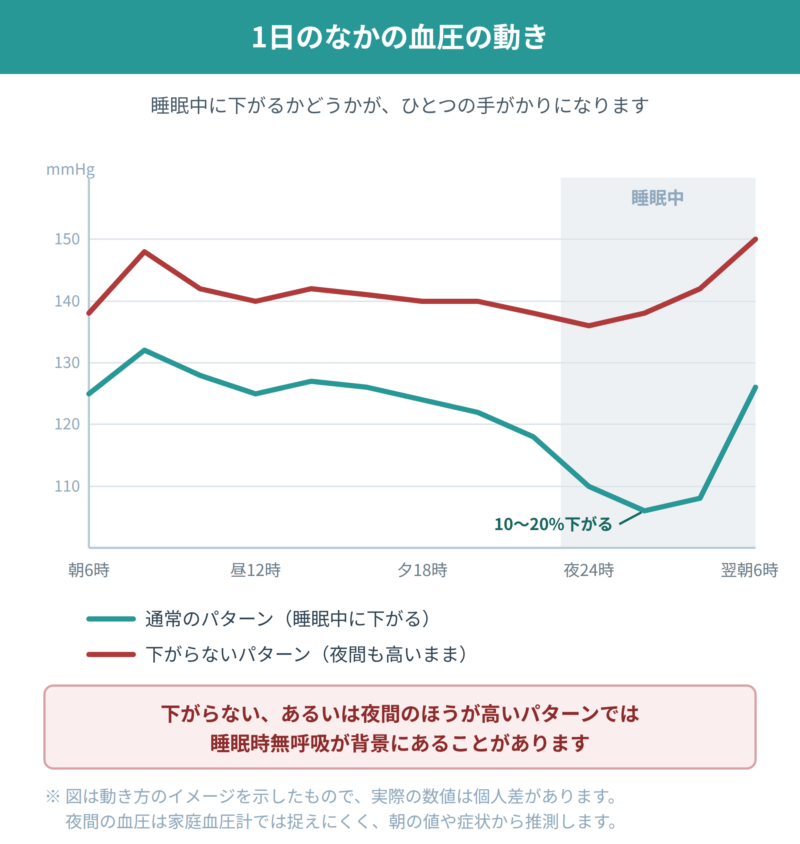 1日のなかの血圧の動きを示した折れ線グラフ。睡眠中に10〜20%下がる通常のパターンと、夜間も高いまま下がらないパターンを比較している。