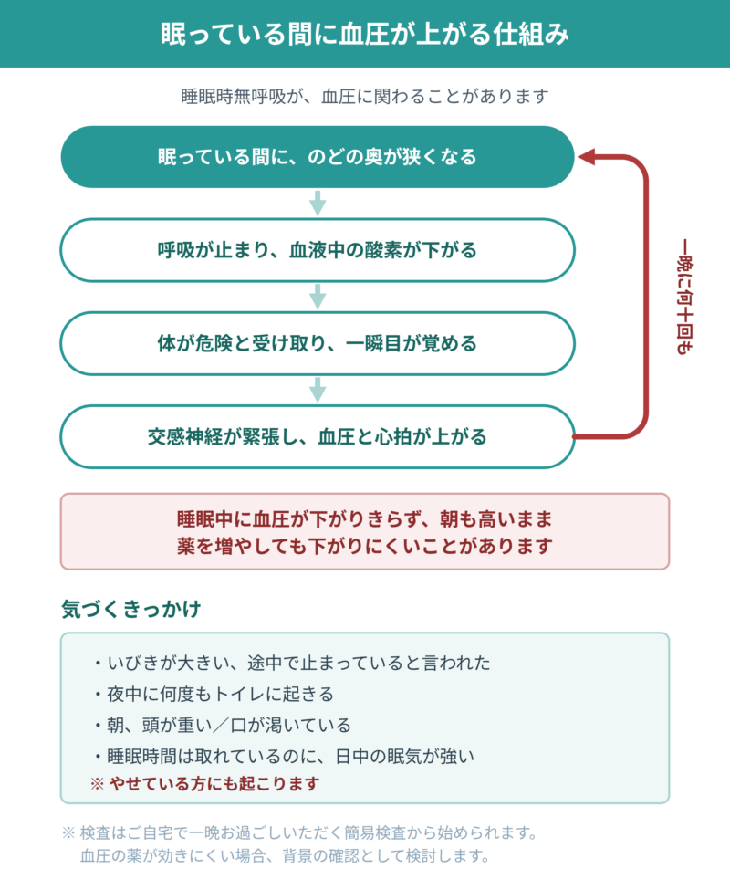 睡眠時無呼吸によって夜間の血圧が上がる流れを示した図。のどの奥が狭くなる、酸素が下がる、一瞬目が覚める、交感神経が緊張して血圧が上がる、という4段階が一晩に何十回も繰り返されることを示している。